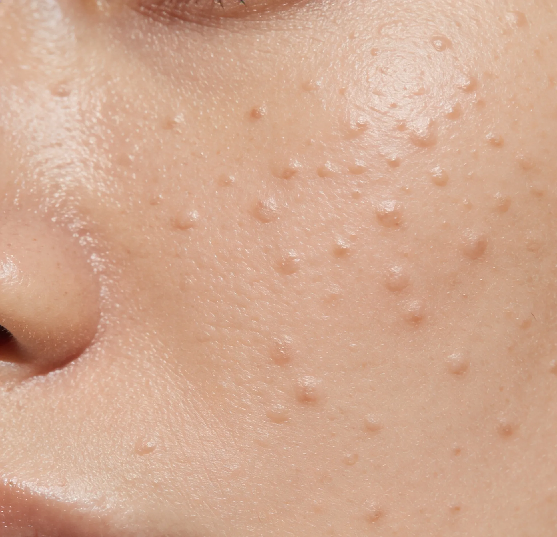 A neutral skin-toned background with small variations in bump appearance