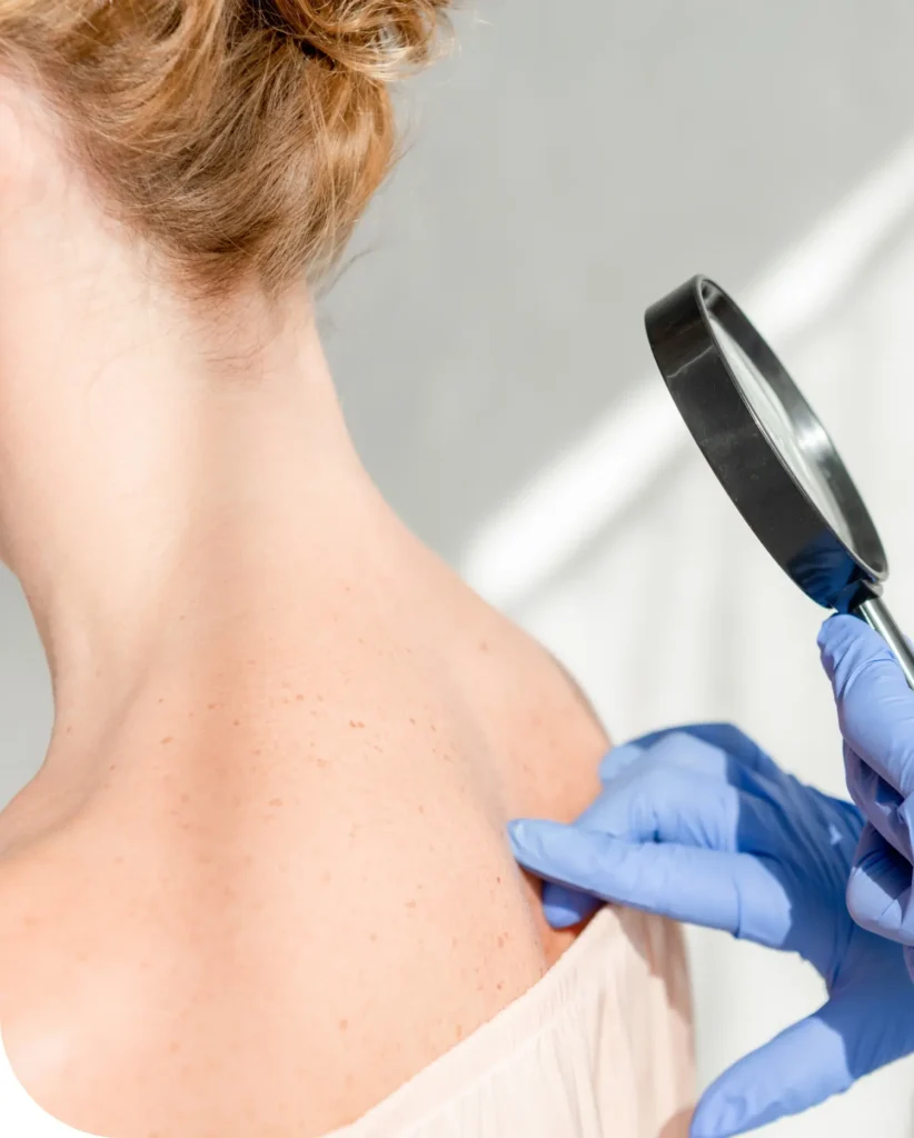 Clinician examining the upper back with a magnifying glass.